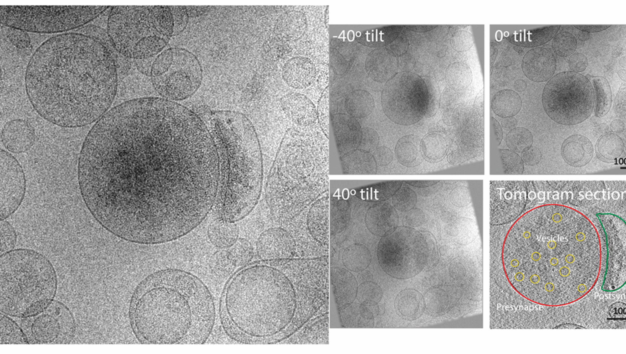 Figure 3. Examples of Cryo Electron Tomography (CET) of synaptic connections isolated from rat brain. Credit Thomas Lykke-Møller Sørensen.